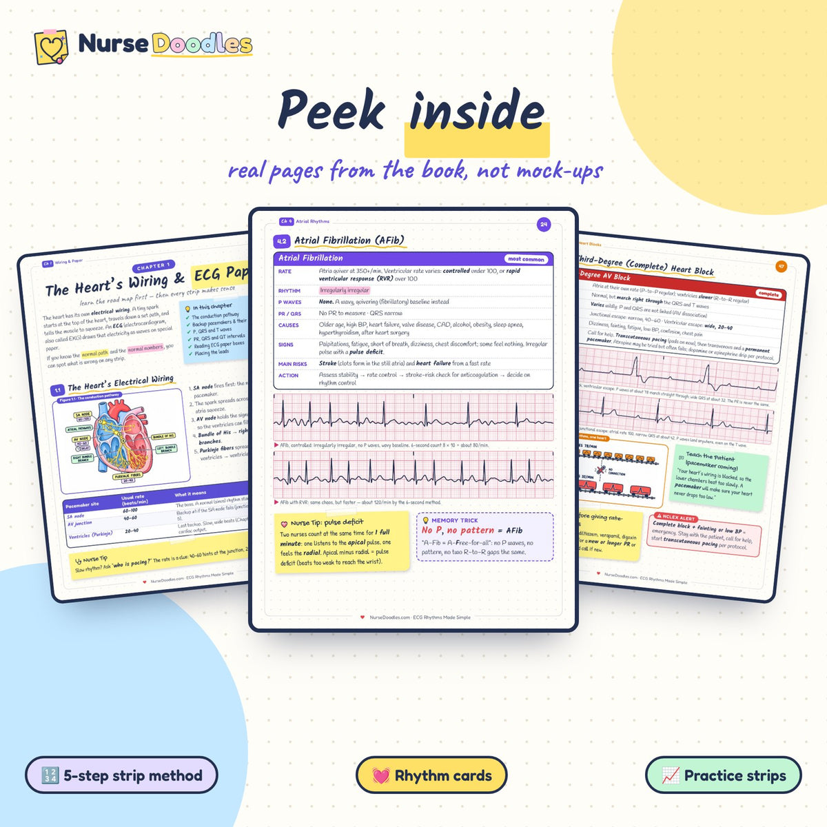 Peek inside: real pages from ECG Rhythms Made Simple
